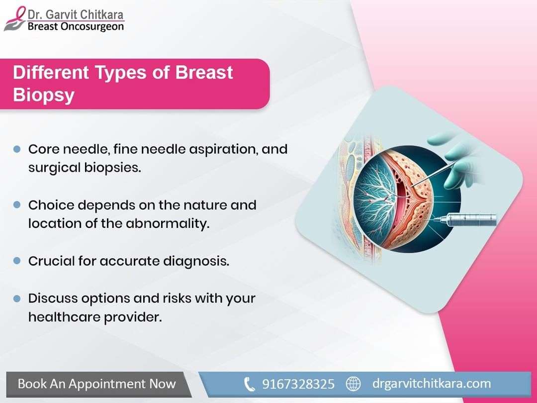 Breast biopsy