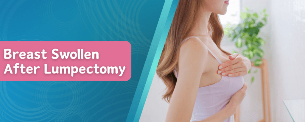 Breast Swollen After Lumpectomy