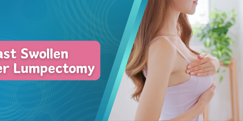 Breast Swollen After Lumpectomy