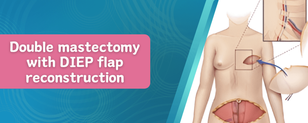 Double Mastectomy with DIEP Flap Reconstruction