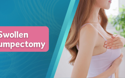 Breast Swollen After Lumpectomy