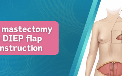Double Mastectomy with DIEP Flap Reconstruction