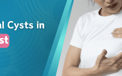 Several Cysts in Breast