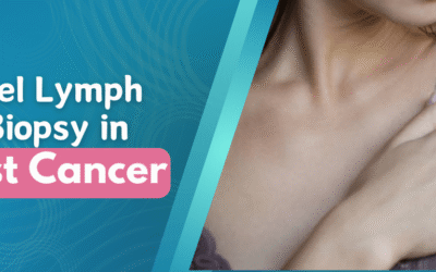 Sentinel Lymph Node Biopsy in Breast Cancer
