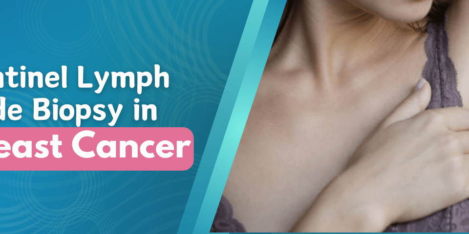Sentinel Lymph Node Biopsy in Breast Cancer