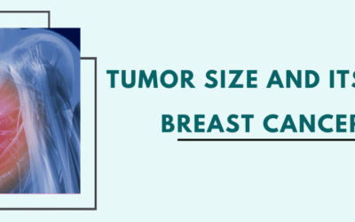 Tumor Size And Its Impact On Breast Cancer Stage