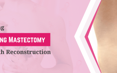 Understanding Nipple Sparing Mastectomy with Reconstruction