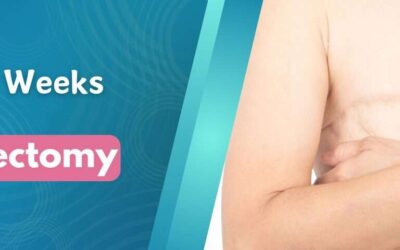 Pain 3 Weeks After Mastectomy