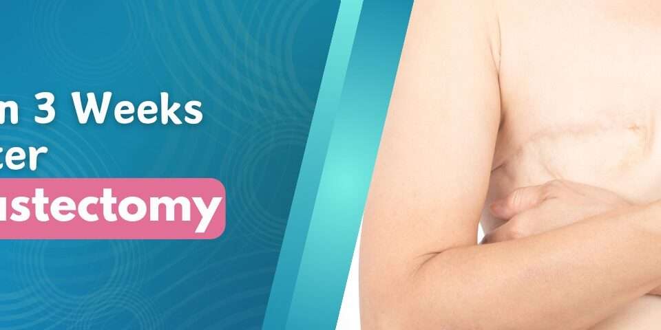 Pain 3 Weeks After Mastectomy