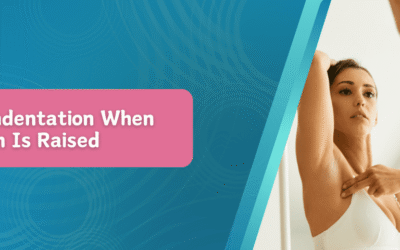 Breast Indentation When Arm Is Raised
