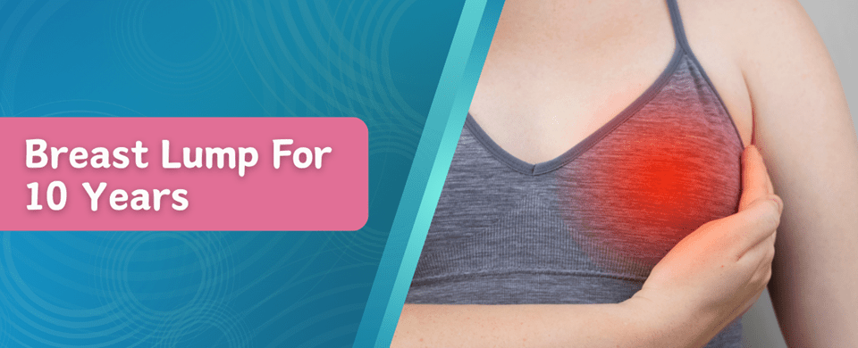 Breast lump for 10 years