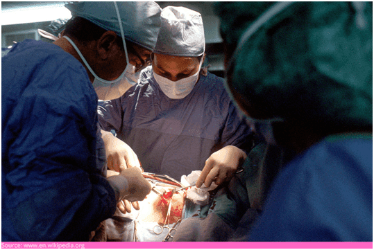 What is the surgical biopsy procedure? What is the surgical biopsy procedure?