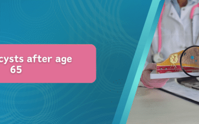 Breast Cysts After Age 65