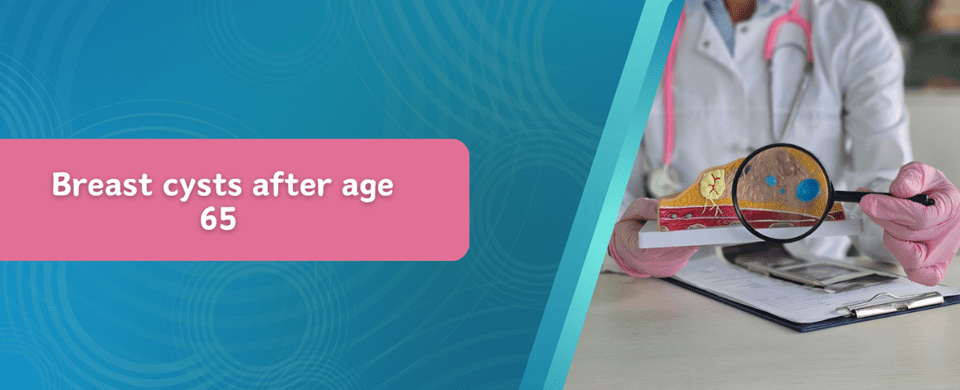 Breast Cysts After Age 65