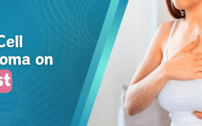 Basal Cell Carcinoma on Breast