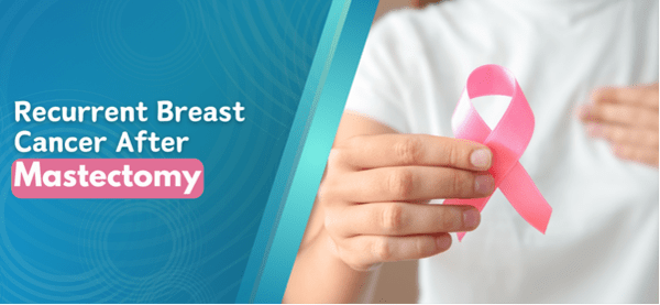 Recurrent Breast Cancer After Mastectomy