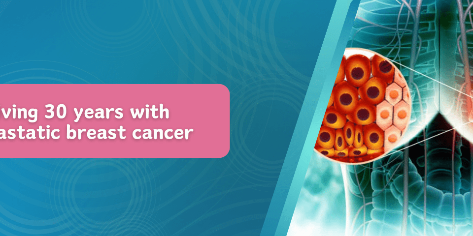 Living 30 Years with Metastatic Breast Cancer
