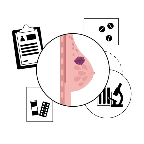 treatment-options-for-fibroadenoma When to consult the doctor?