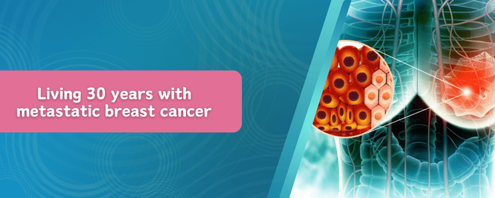 Living 30 Years with Metastatic Breast Cancer