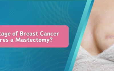 What Stage of Breast Cancer Requires a Mastectomy?