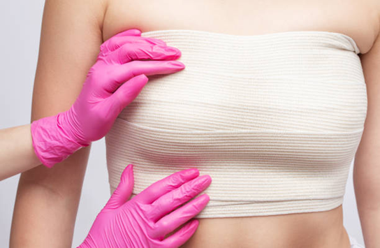 Surgical illustration showing breast reconstruction options after mastectomy including implant and tissue based methods