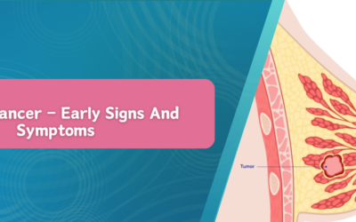 Breast Cancer – Early Signs And Symptoms
