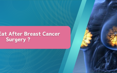 What to Eat After Breast Cancer Surgery ?