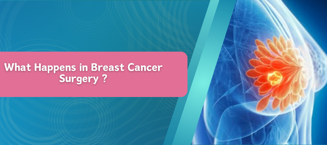 What Happens in Breast Cancer Surgery ?