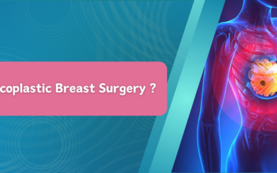 What Is Oncoplastic Breast Surgery ?