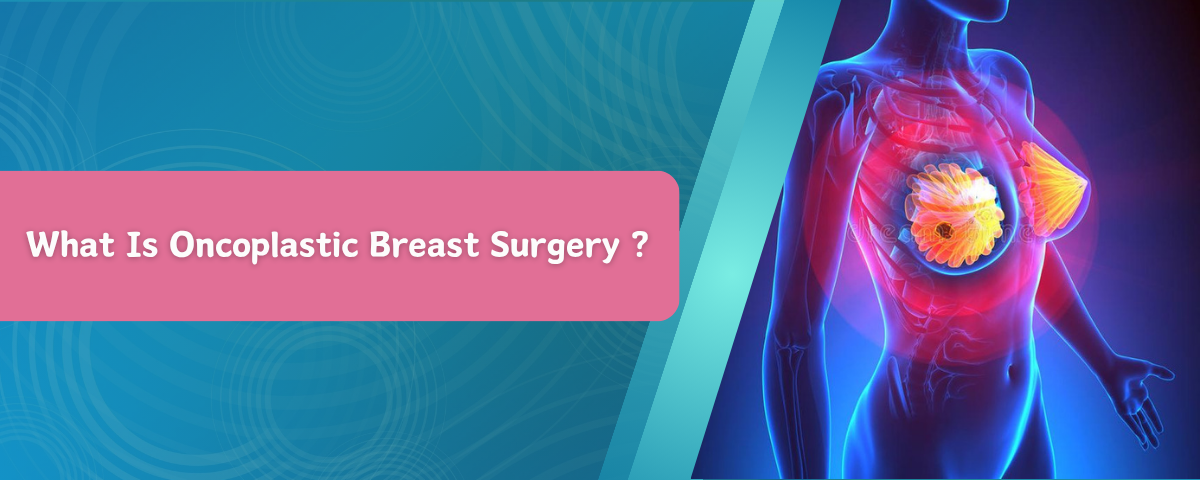 What Is Oncoplastic Breast Surgery ?