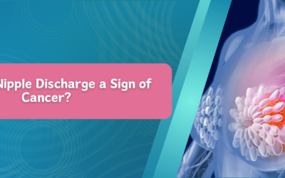 When Is Nipple Discharge a Sign of Cancer?