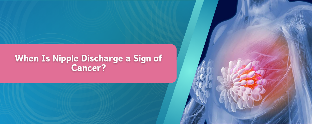 When Is Nipple Discharge a Sign of Cancer?