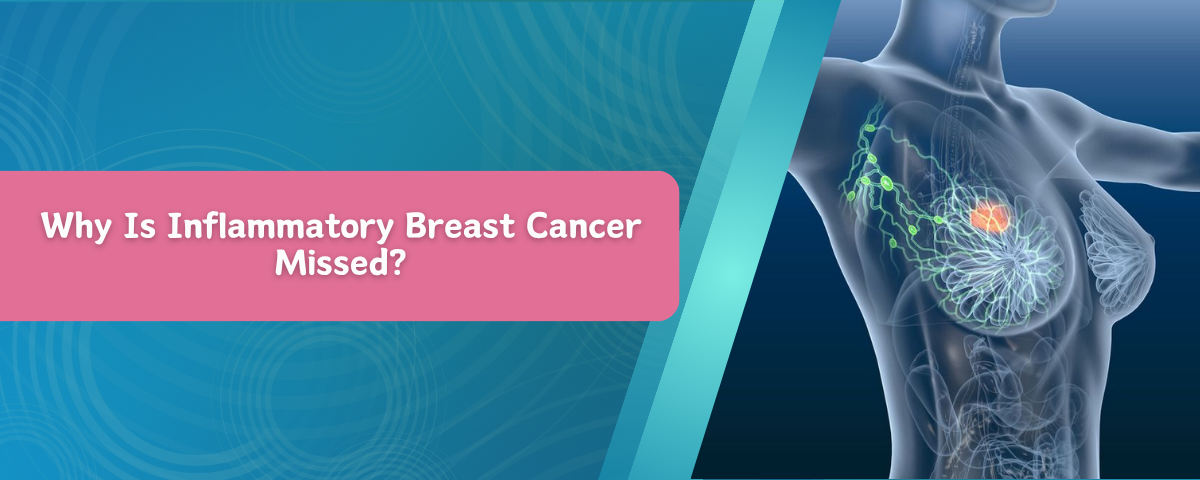 Why Is Inflammatory Breast Cancer Missed?