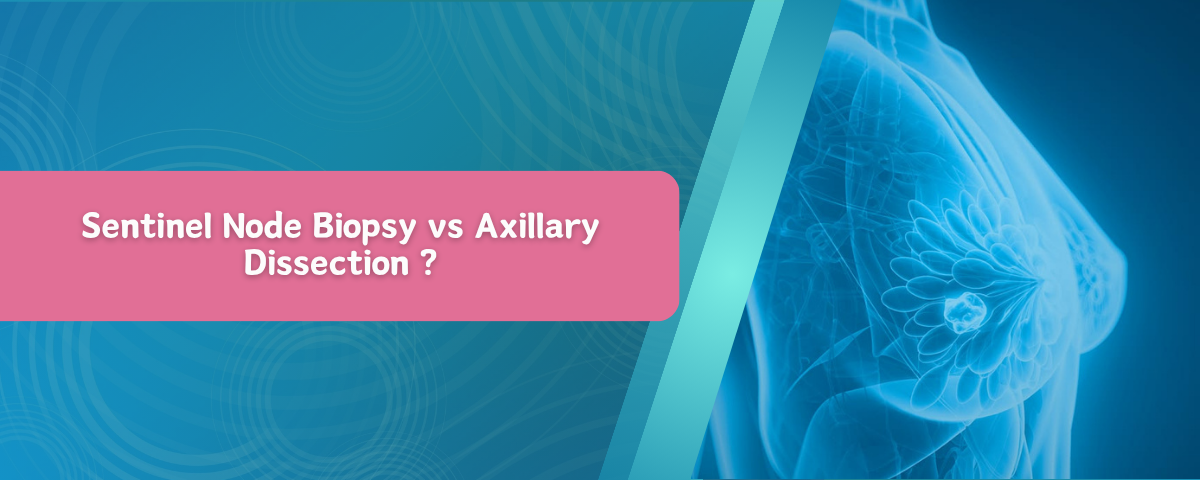 Sentinel Node Biopsy vs Axillary Dissection ?