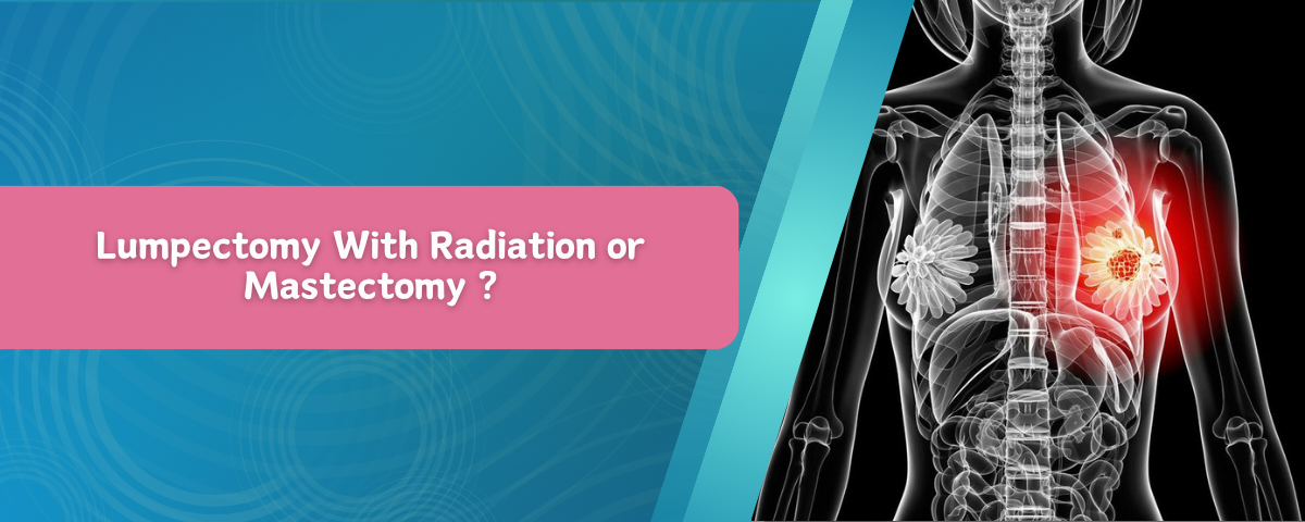 Lumpectomy With Radiation or Mastectomy ?