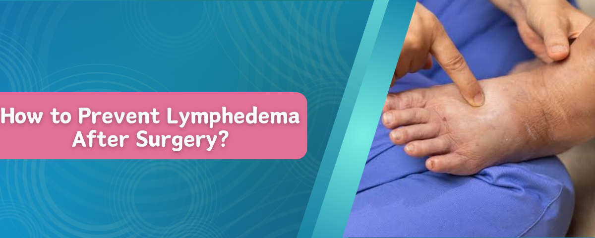 How to Prevent Lymphedema After Surgery?