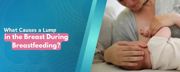 What Causes a Lump in the Breast During Breastfeeding?